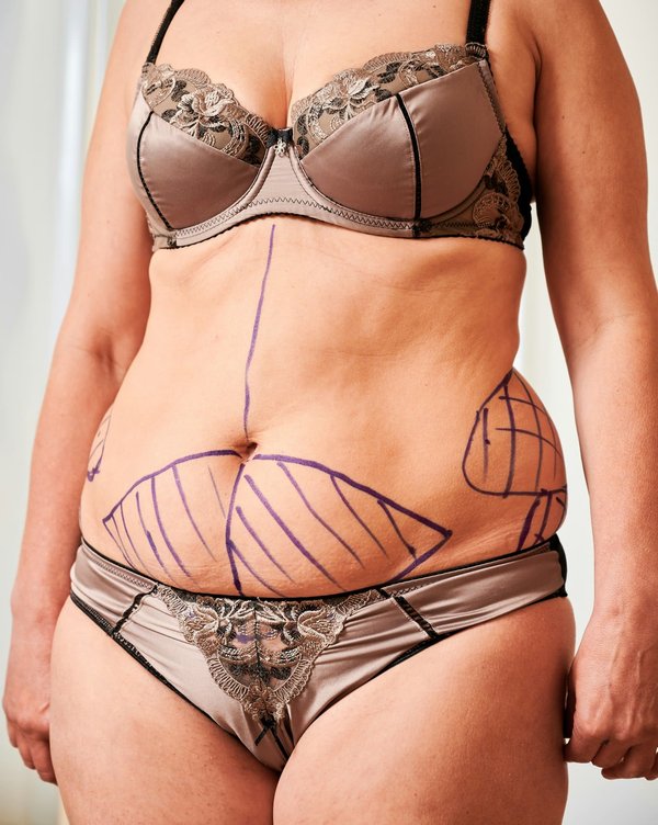 Dre Teresa Rotunno, votre choix en esthétique